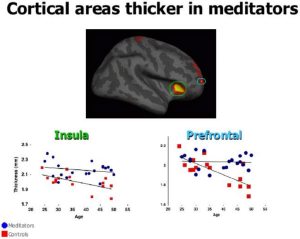insight meditators brains