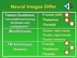 variations in types of meditation on brain parts
